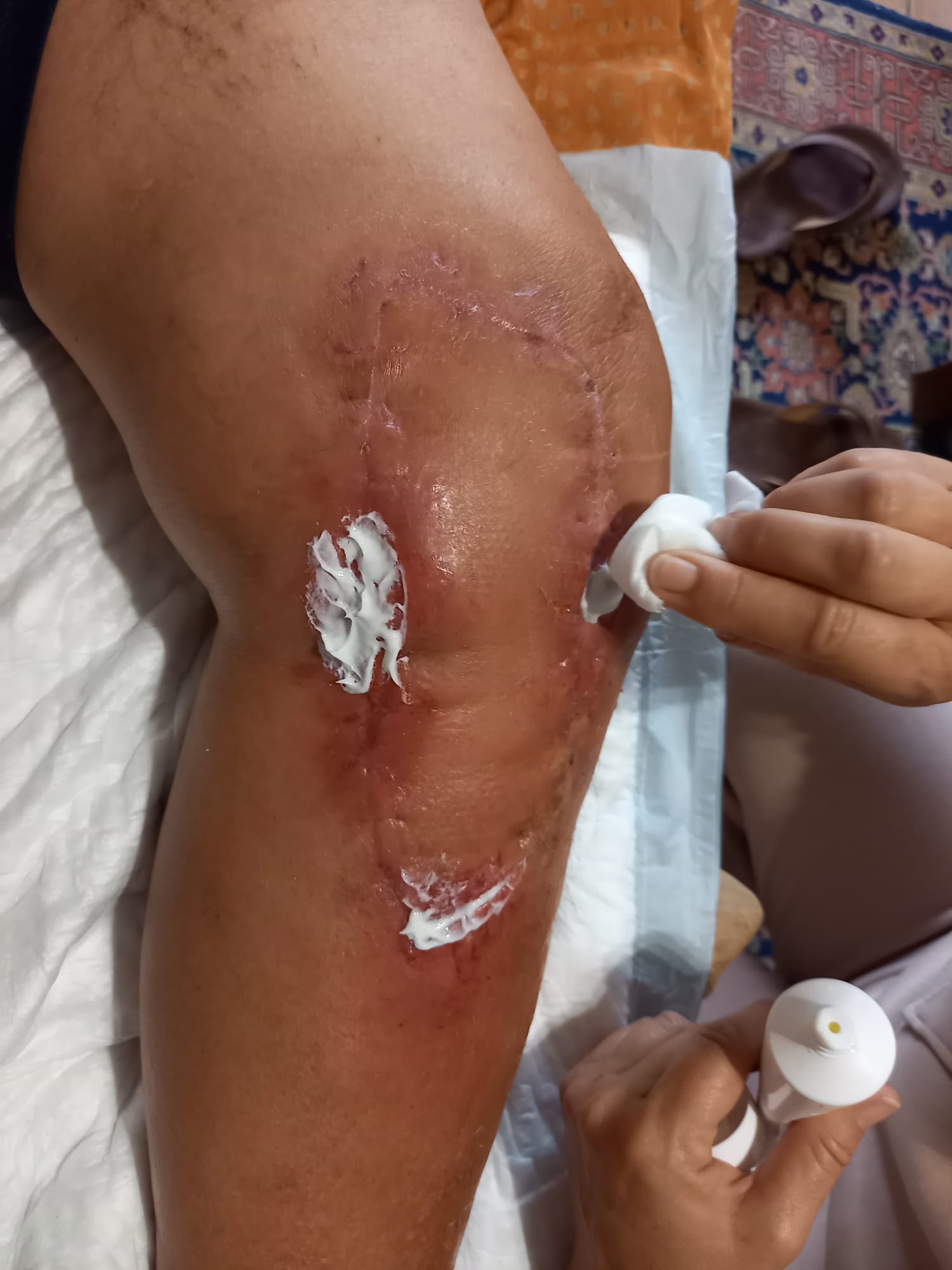 Témoignage médical Philippe F